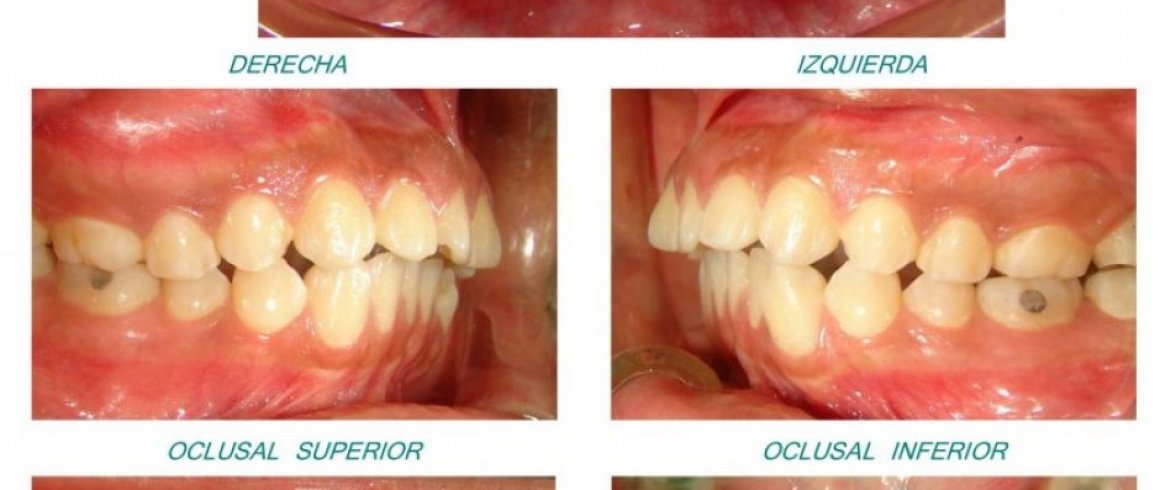 Documentación Ortodontica