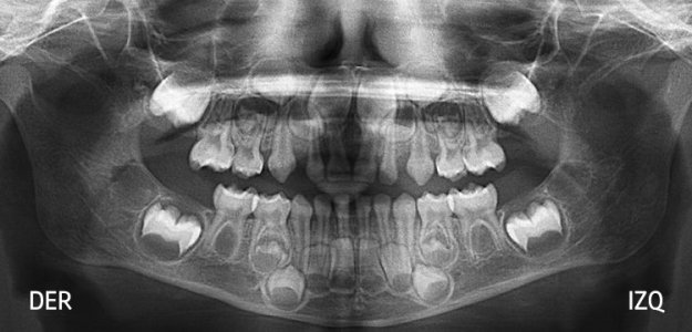 Radiografías Extraorales
